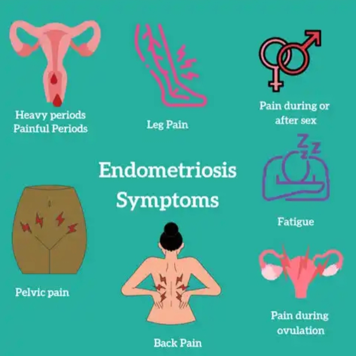 Symptoms Of Endometriosis