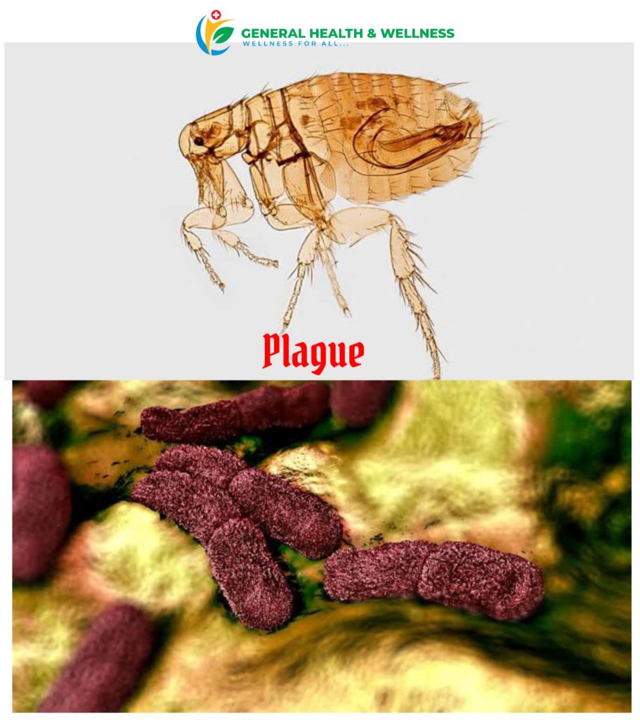 Bubonic Plague