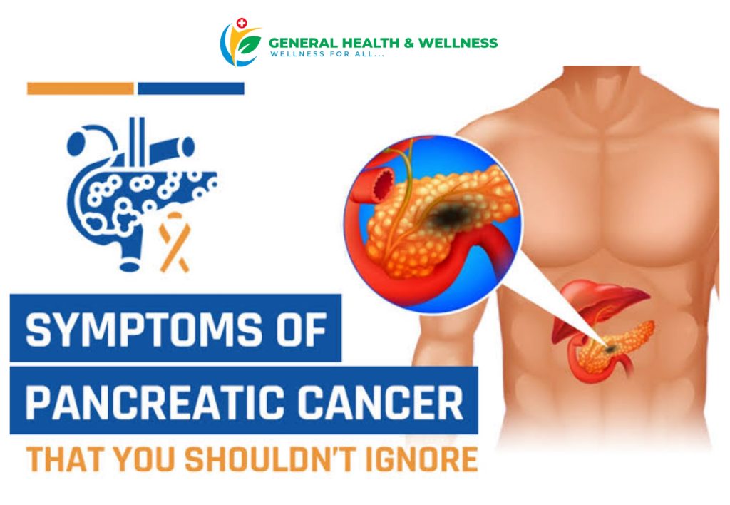 Symptoms Of Pancreatic Cancer